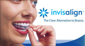 Invisalign Asbury Park NJ