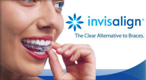 Invisalign Shark River Hills NJ