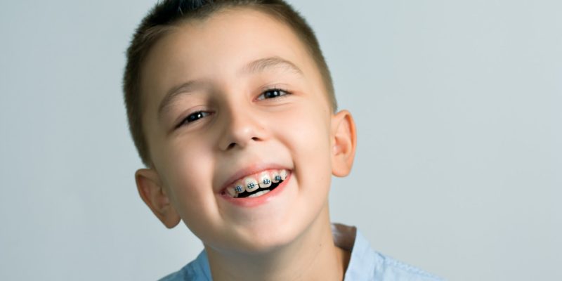 When Should Kids Get Braces? A Simple Guide for Monmouth County NJ Parents
